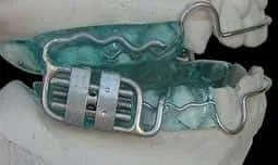 Aparelho intraoral para ronco e apneia